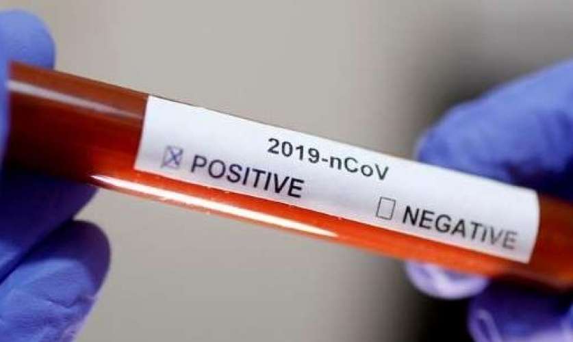 Com aumento do número de casos, Ubatuba reforça medidas de prevenção contra a Covid-19