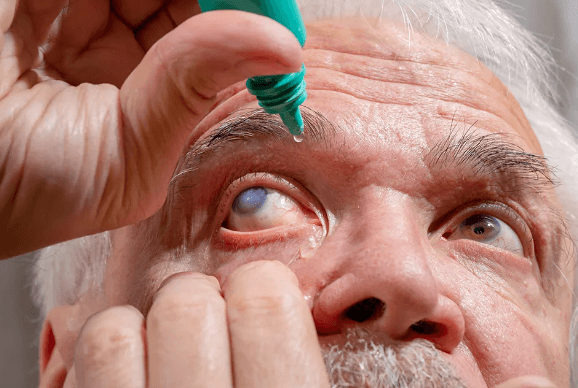 Campanha alerta para riscos do glaucoma e importância da prevenção