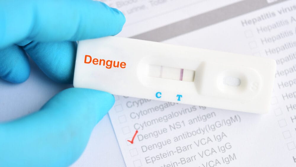 Taubaté realiza pregão para aquisição de testes de dengue