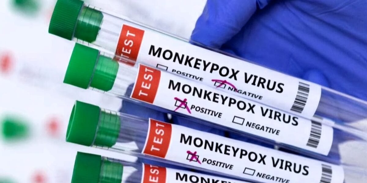Anvisa libera importação de vacinas e remédios contra mpox sem necessidade de registro