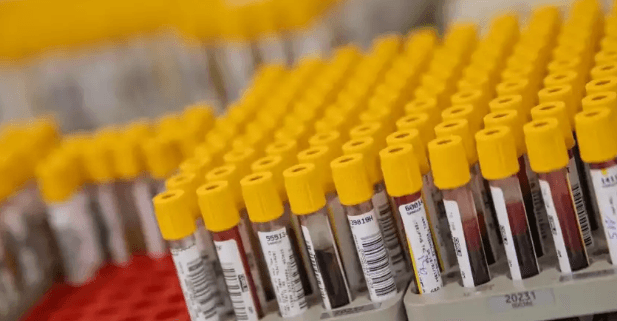 Taubaté amplia capacidade de exames laboratoriais com mutirão para reduzir fila de espera