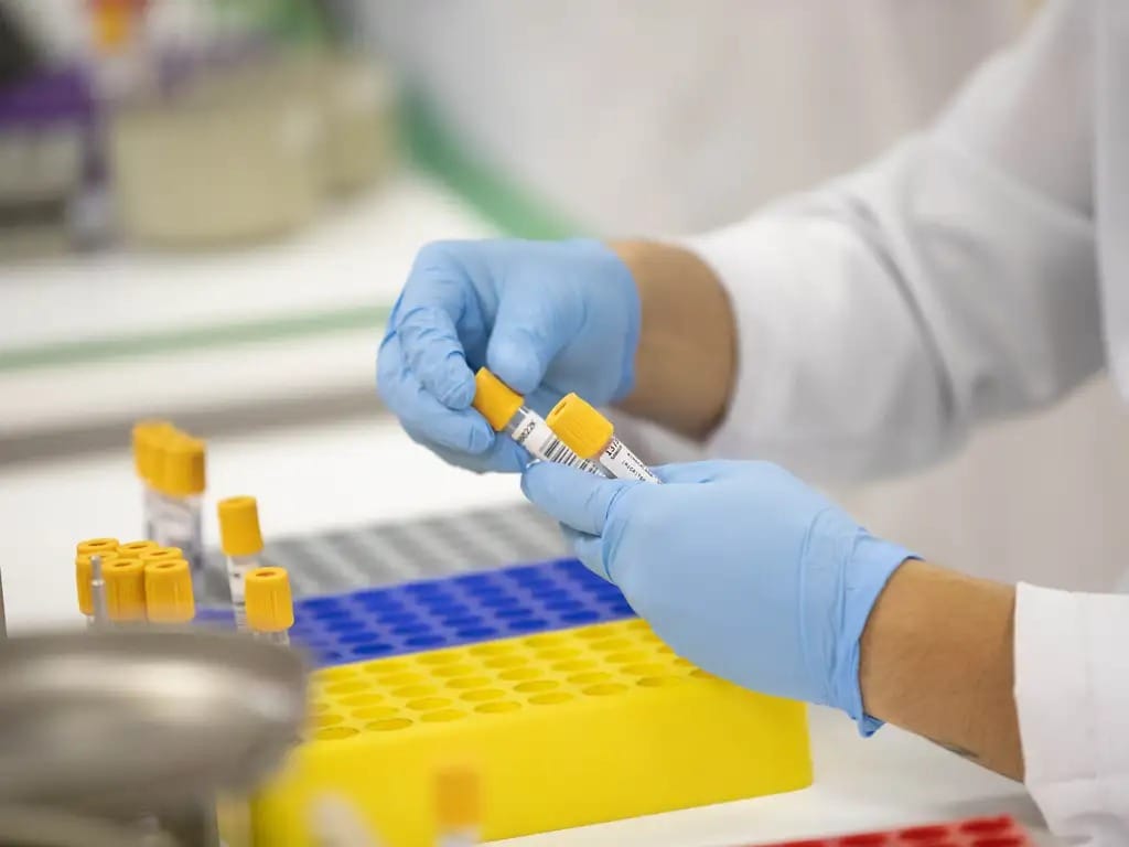 Prefeitura de Taubaté descentraliza coleta de exames laboratoriais nas unidades de saúde