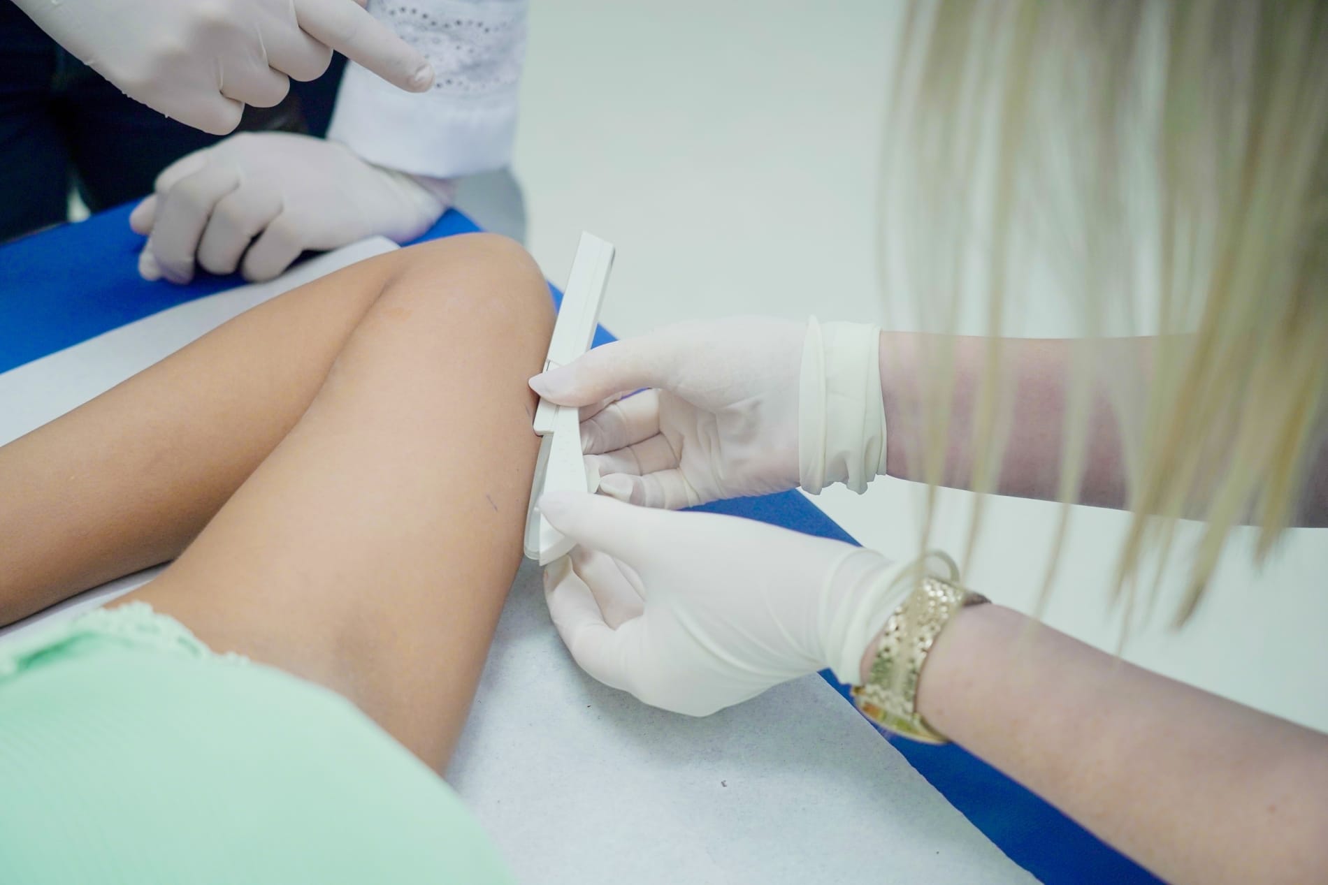 Planos de saúde terão de oferecer implante contraceptivo hormonal